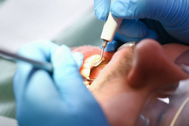 Best Tooth Pain Emergency Relief  in Mcmurray, PA