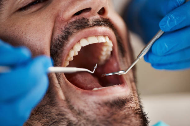Best Tooth Pain Emergency Relief  in Mcmurray, PA